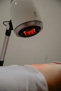 supercharge fertile period for pregnancy with acupuncture