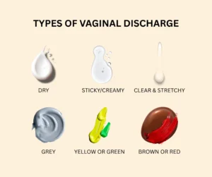 Tracking Vaginal Discharge for Conception