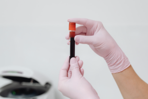 Fertility Test Singapore: Blending Western Science with TCM