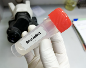Fertility Test Singapore - semen analysis
