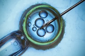 Microscopic view of ICSI fertilizing an egg to boost IVF success rate Singapore.