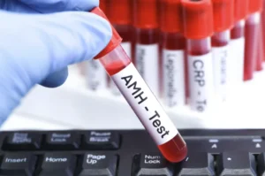 Gloved scientist holding a blood sample vial labeled AMH Test for low amh test singapore.